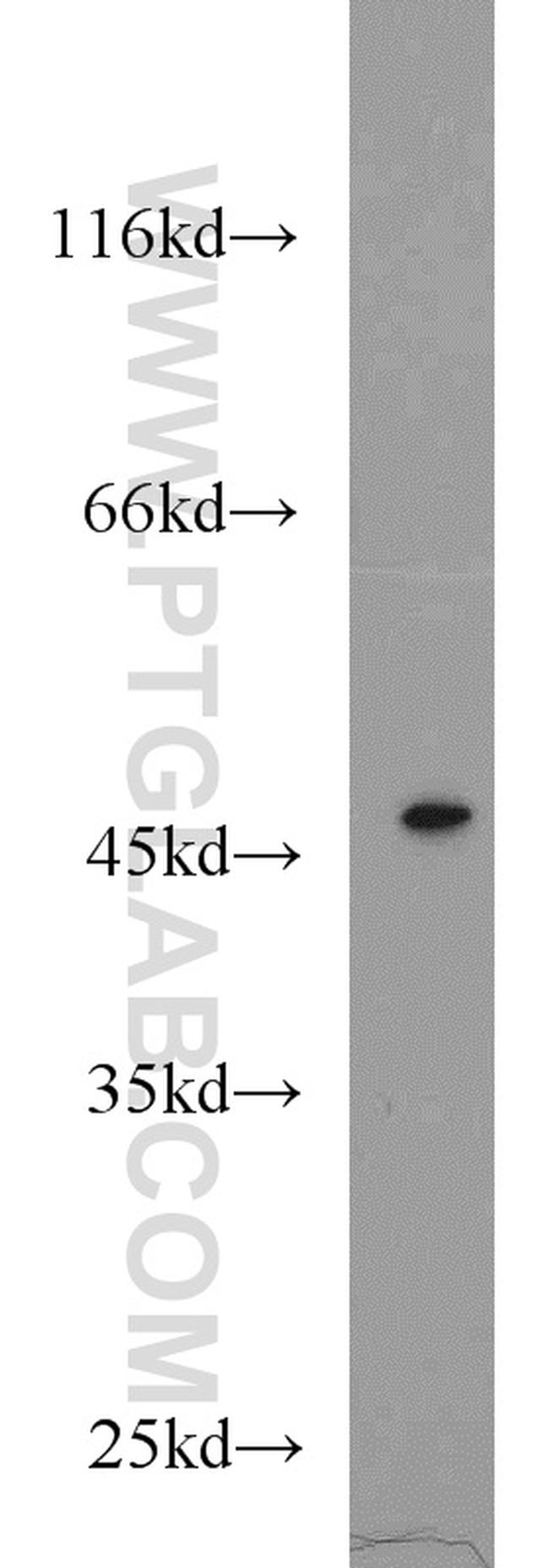 TSC22D4 Antibody in Western Blot (WB)