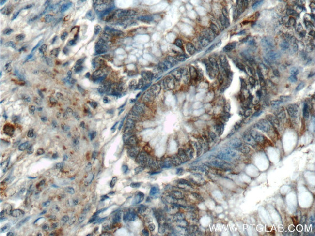 Annexin A1 Antibody in Immunohistochemistry (Paraffin) (IHC (P))