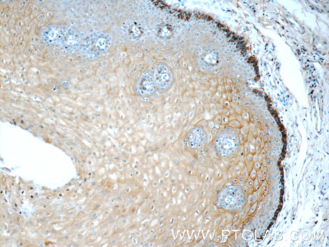 Annexin A1 Antibody in Immunohistochemistry (Paraffin) (IHC (P))