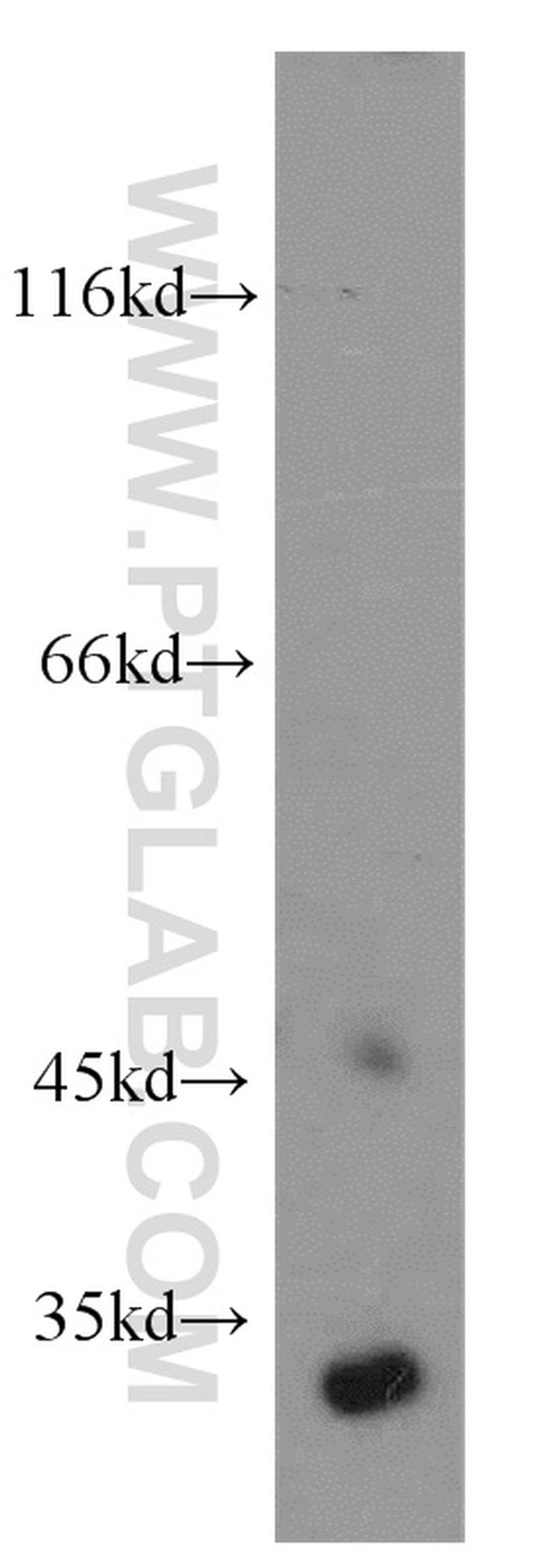 Cathepsin D Antibody in Western Blot (WB)