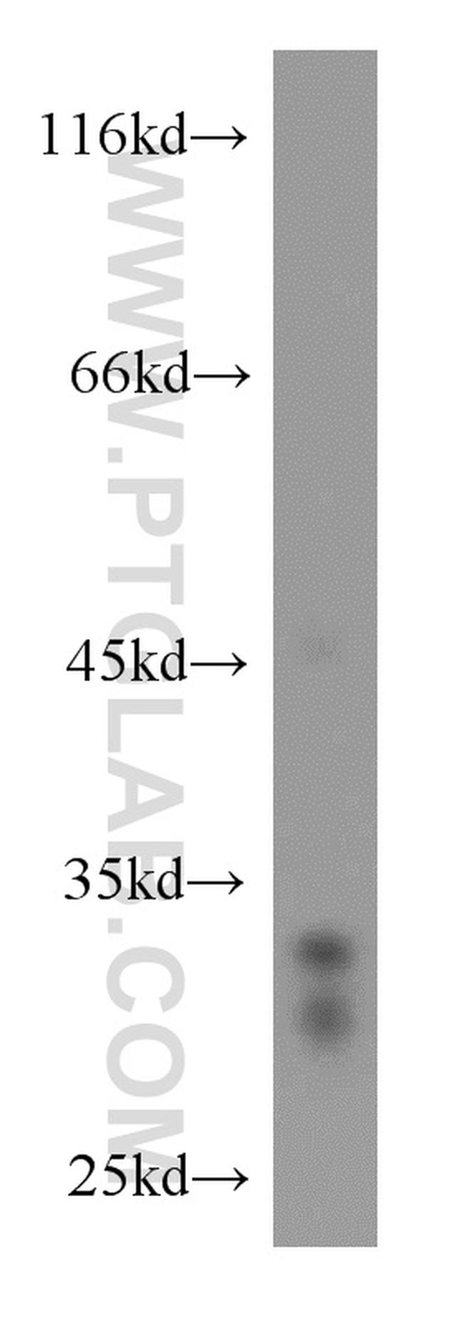 Cathepsin D Antibody in Western Blot (WB)