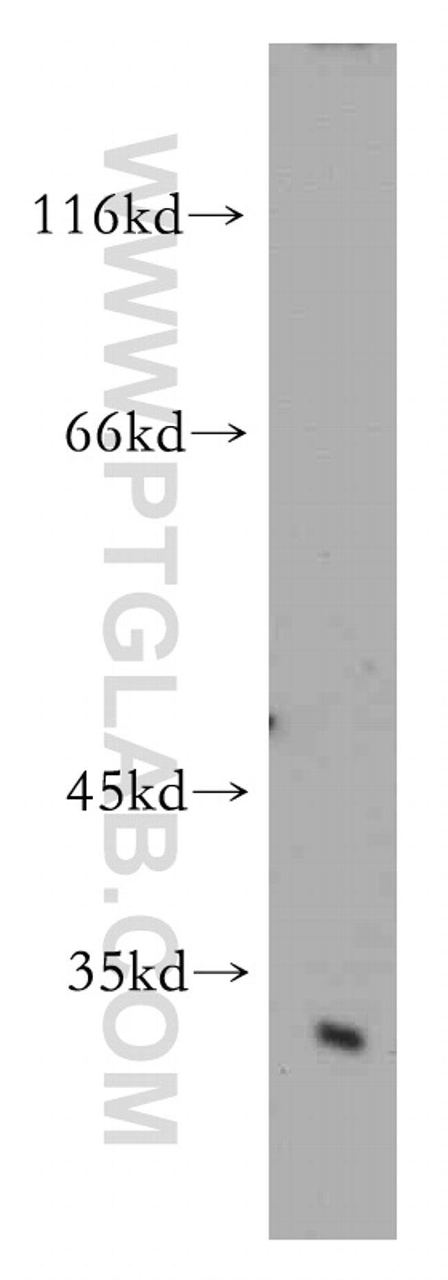 Cathepsin D Antibody in Western Blot (WB)