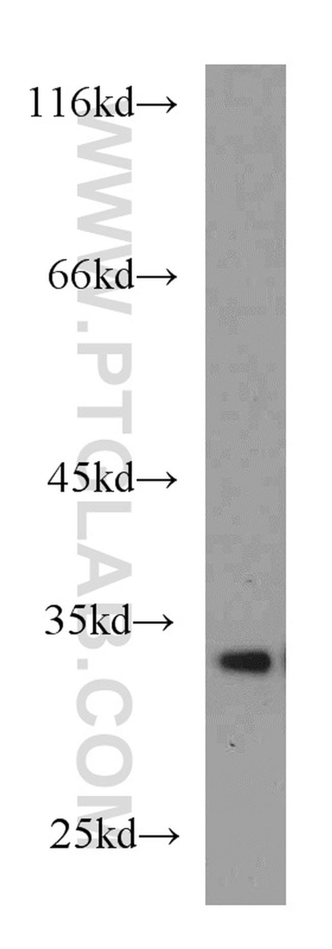 Cathepsin D Antibody in Western Blot (WB)