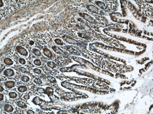 ELOVL4 Antibody in Immunohistochemistry (Paraffin) (IHC (P))