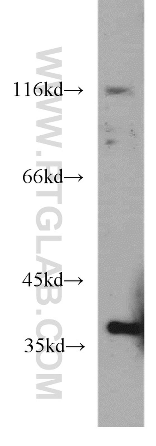 ELOVL4 Antibody in Western Blot (WB)