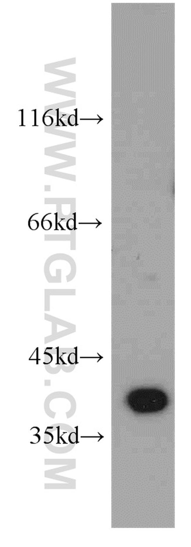 ELOVL4 Antibody in Western Blot (WB)