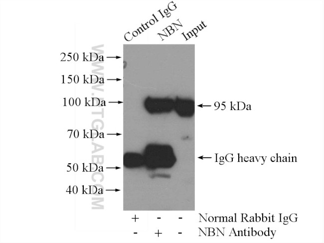 NBS1 Antibody in Immunoprecipitation (IP)