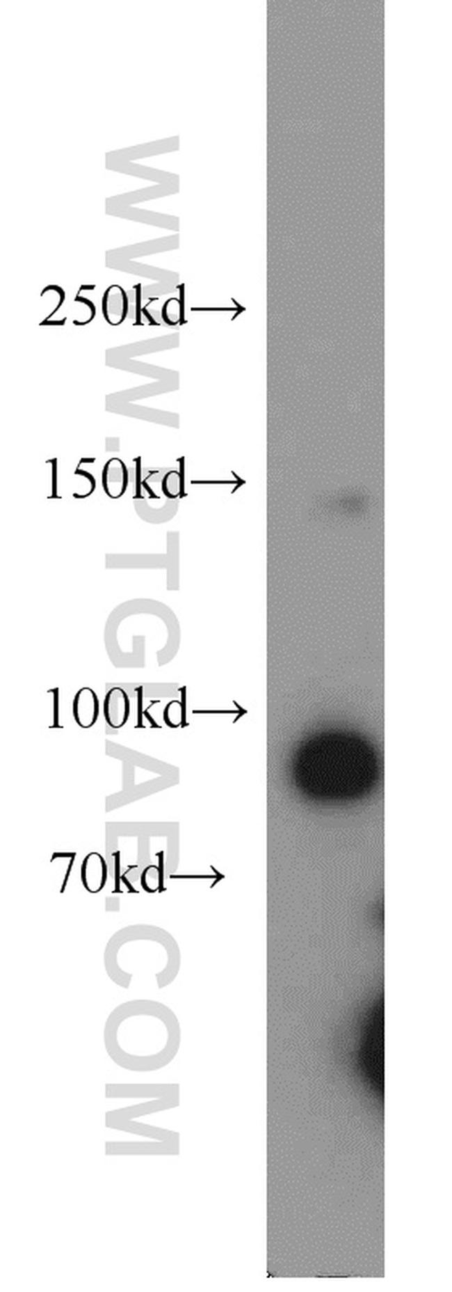 NBS1 Antibody in Western Blot (WB)