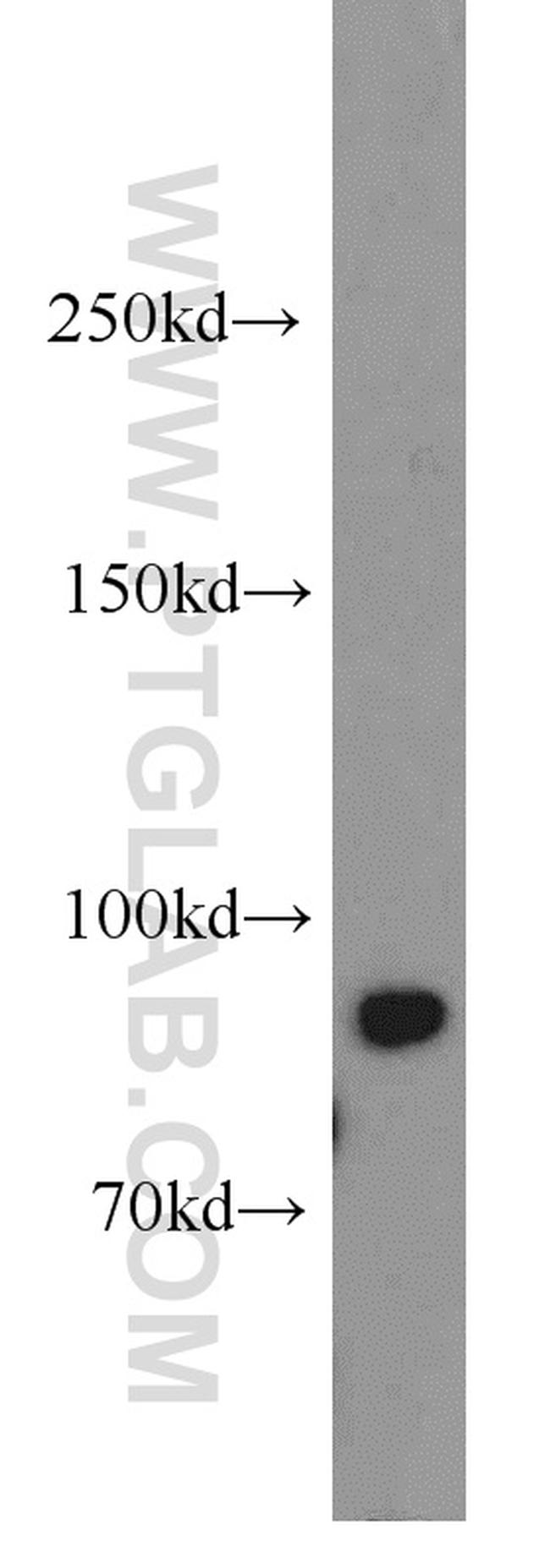 NBS1 Antibody in Western Blot (WB)