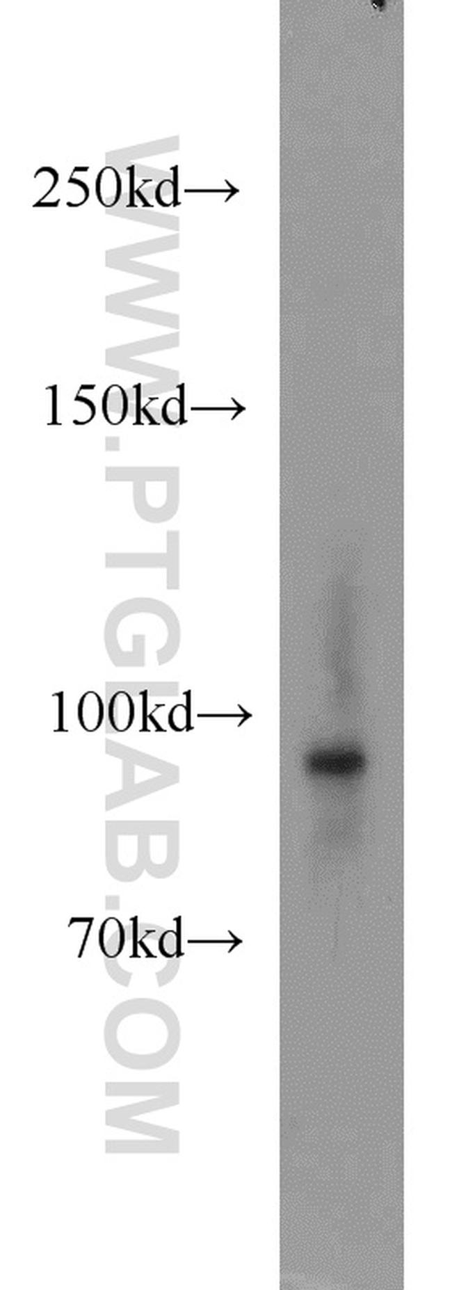 NBS1 Antibody in Western Blot (WB)