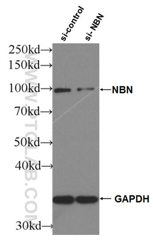 NBS1 Antibody in Western Blot (WB)