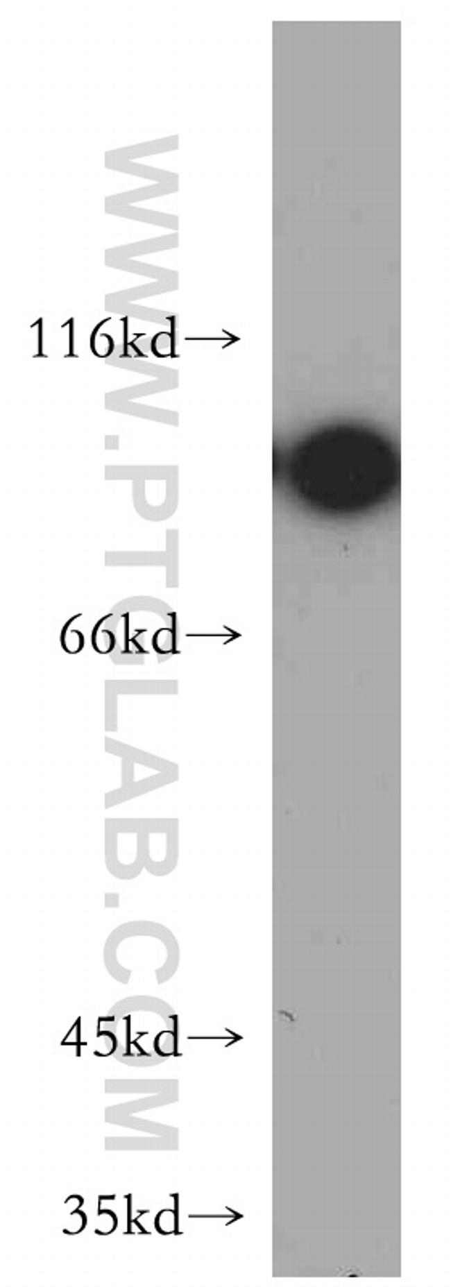 NBS1 Antibody in Western Blot (WB)