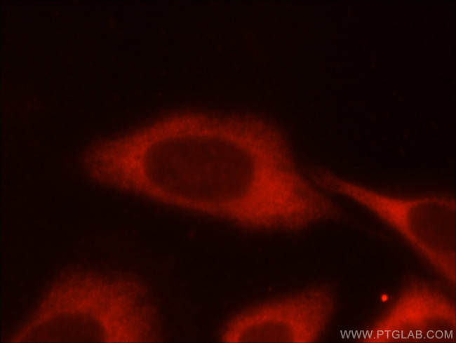 PFKM Antibody in Immunocytochemistry (ICC/IF)