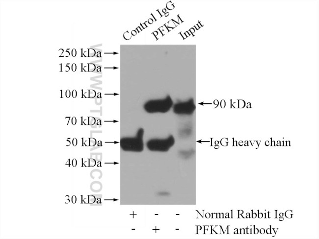 PFKM Antibody in Immunoprecipitation (IP)