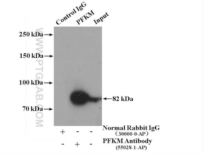 PFKM Antibody in Immunoprecipitation (IP)