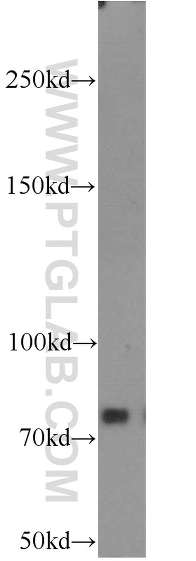 PFKM Antibody in Western Blot (WB)