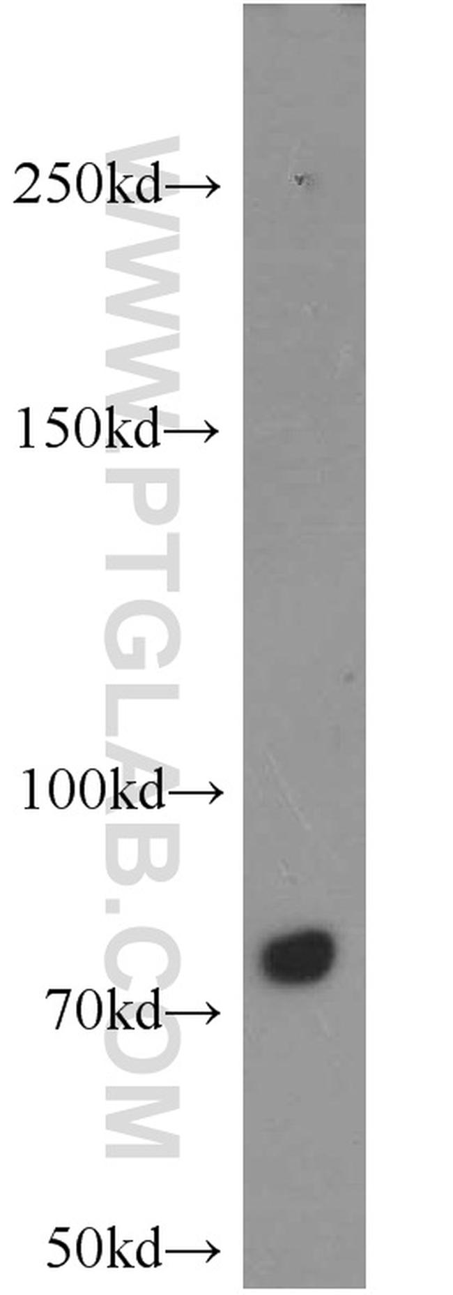 PFKM Antibody in Western Blot (WB)