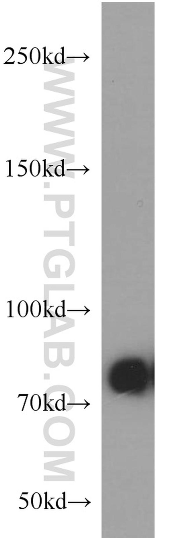 PFKM Antibody in Western Blot (WB)