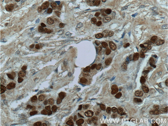 CDC25A Antibody in Immunohistochemistry (Paraffin) (IHC (P))