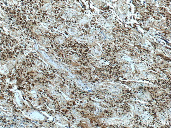 CDC25A Antibody in Immunohistochemistry (Paraffin) (IHC (P))