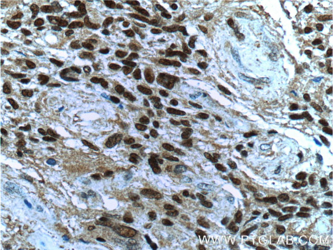 CDC25A Antibody in Immunohistochemistry (Paraffin) (IHC (P))