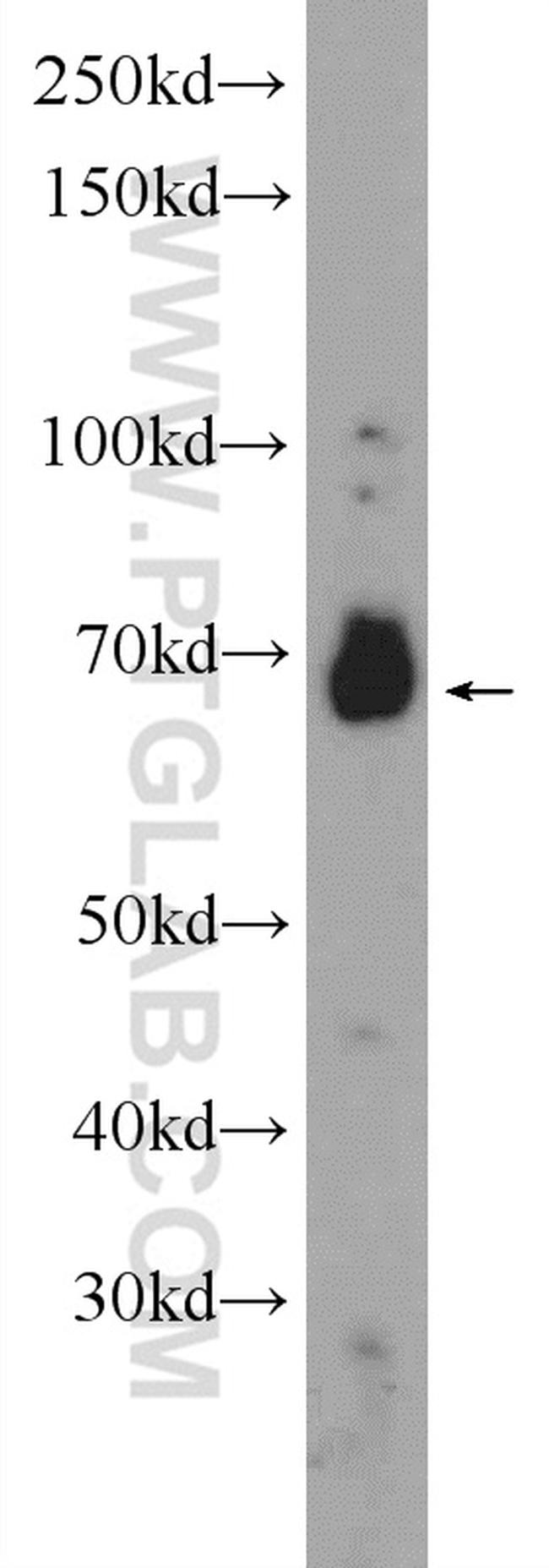 CDC25A Antibody in Western Blot (WB)