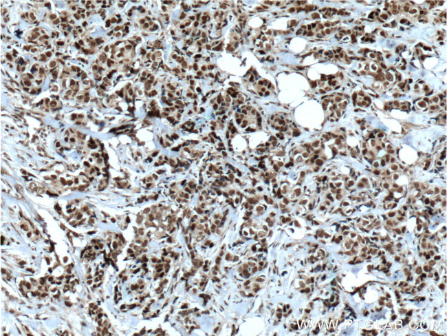 CDC25A Antibody in Immunohistochemistry (Paraffin) (IHC (P))