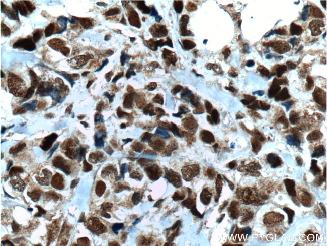 CDC25A Antibody in Immunohistochemistry (Paraffin) (IHC (P))