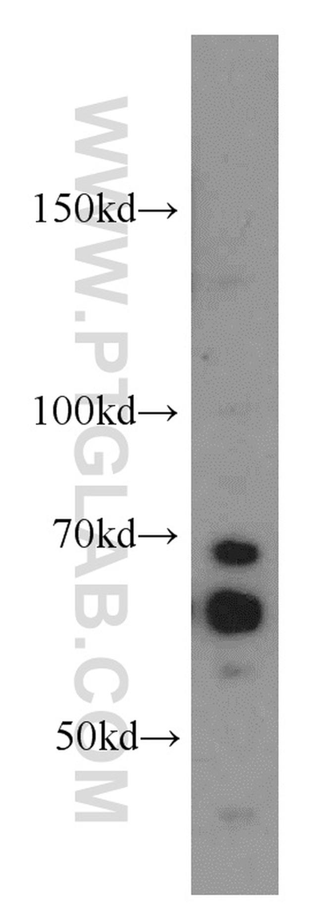 CDC25A Antibody in Western Blot (WB)