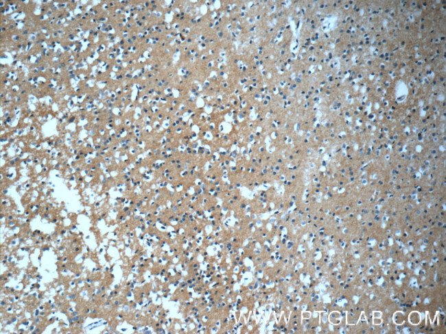 GFRA2 Antibody in Immunohistochemistry (Paraffin) (IHC (P))