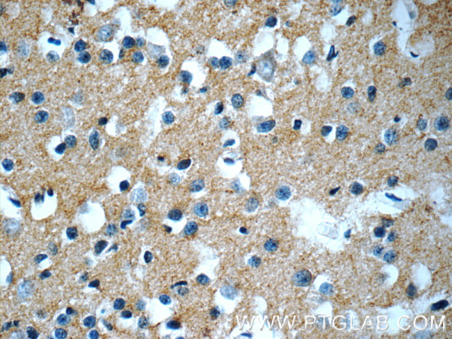 GFRA2 Antibody in Immunohistochemistry (Paraffin) (IHC (P))