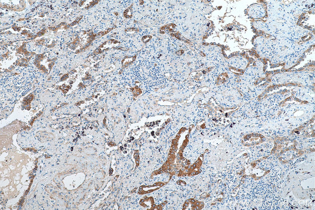 GFRA2 Antibody in Immunohistochemistry (Paraffin) (IHC (P))