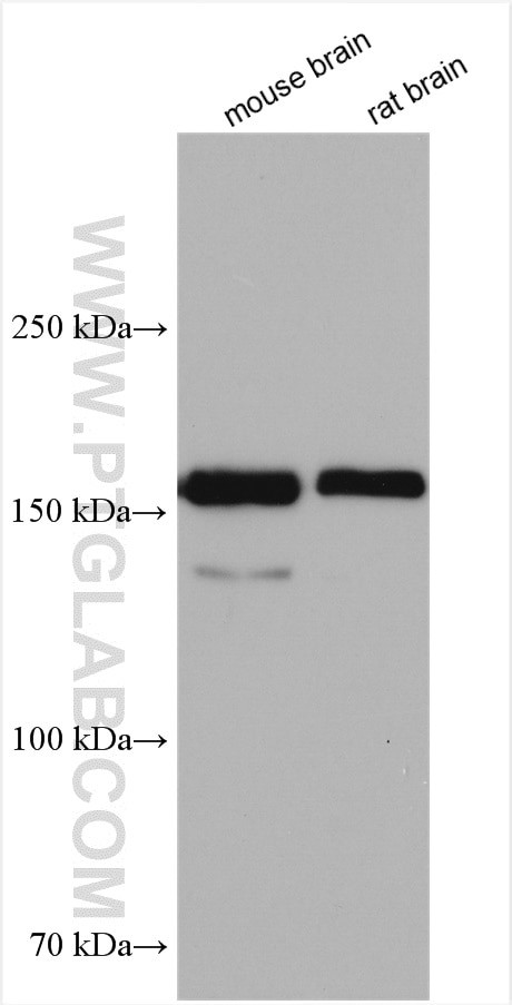 MAGI1 Antibody in Western Blot (WB)