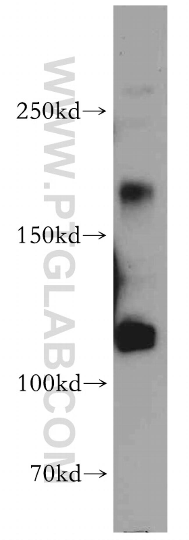 MAGI1 Antibody in Western Blot (WB)