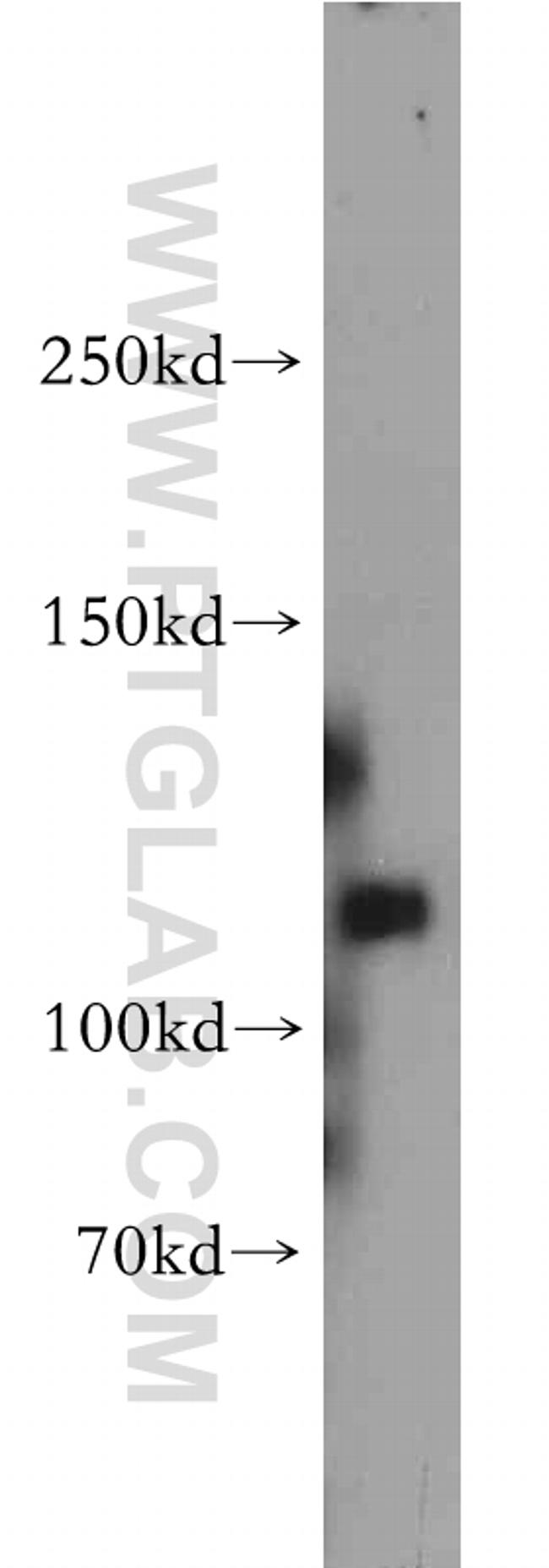 MAGI1 Antibody in Western Blot (WB)