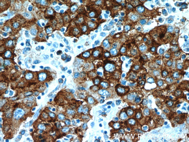 B3GALT6 Antibody in Immunohistochemistry (Paraffin) (IHC (P))