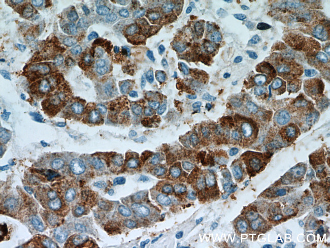 B3GALT6 Antibody in Immunohistochemistry (Paraffin) (IHC (P))