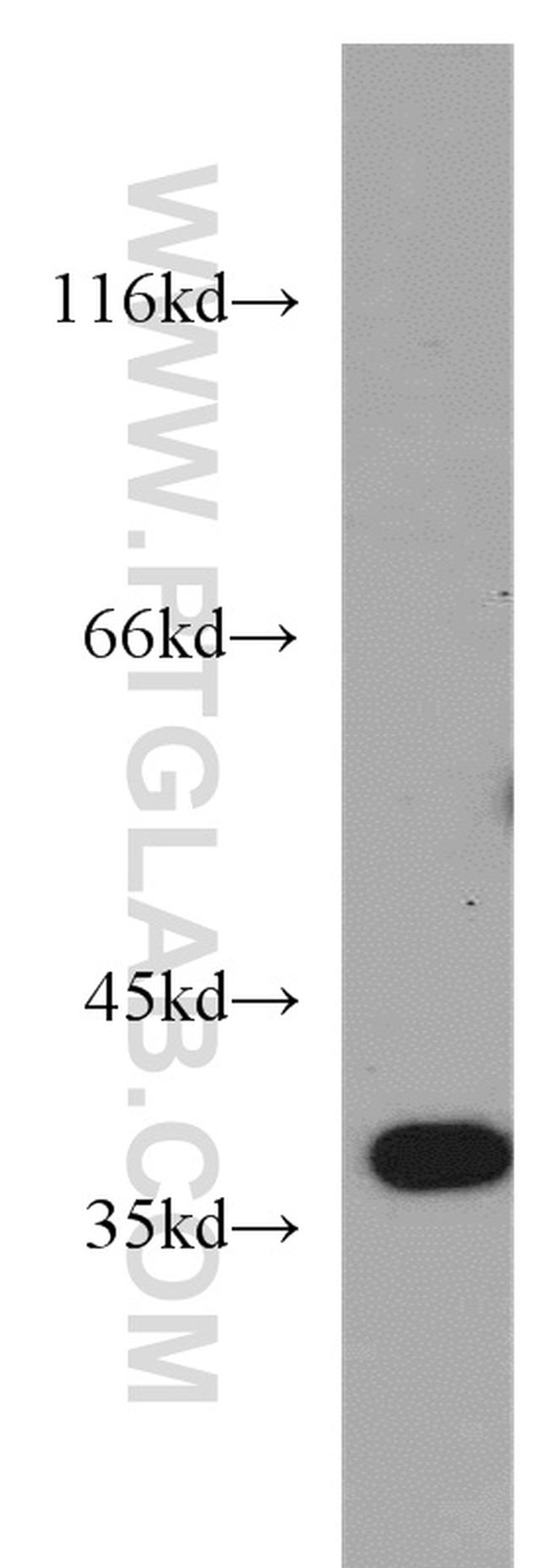 B3GALT6 Antibody in Western Blot (WB)