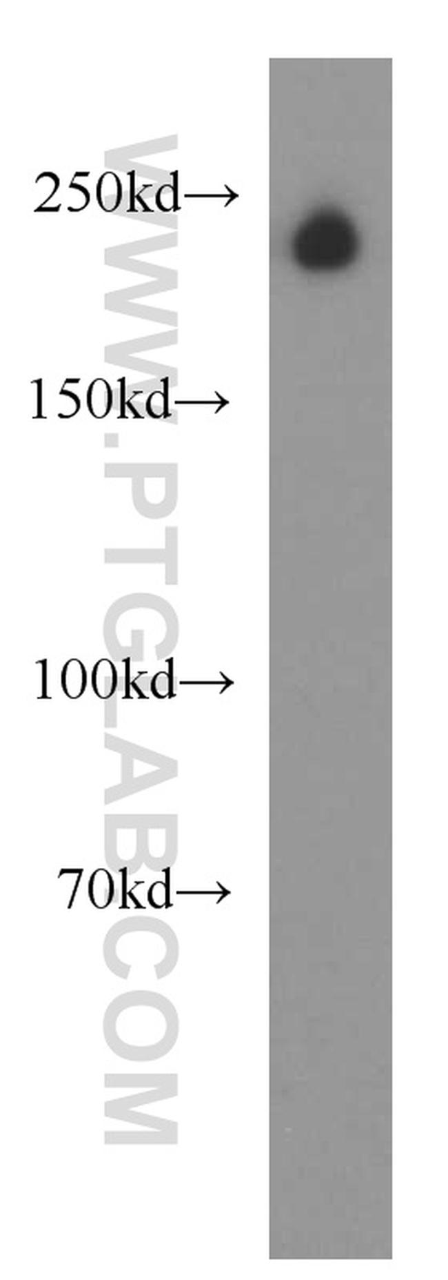 UNC13A/Munc13-1 Antibody in Western Blot (WB)