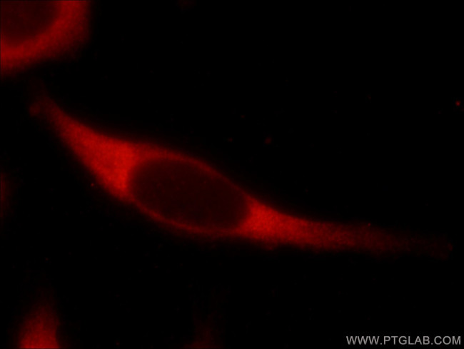 USP9X Antibody in Immunocytochemistry (ICC/IF)