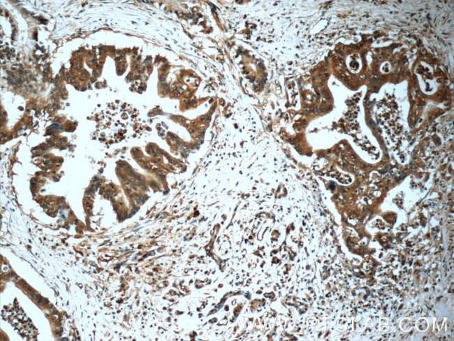 USP9X Antibody in Immunohistochemistry (Paraffin) (IHC (P))