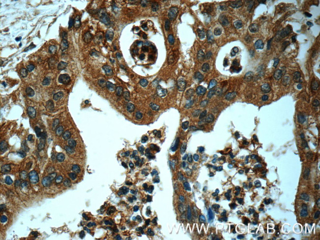 USP9X Antibody in Immunohistochemistry (Paraffin) (IHC (P))