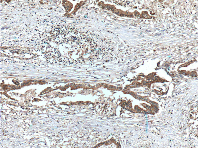 USP9X Antibody in Immunohistochemistry (Paraffin) (IHC (P))