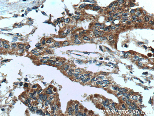 USP9X Antibody in Immunohistochemistry (Paraffin) (IHC (P))