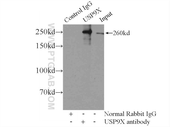 USP9X Antibody in Immunoprecipitation (IP)