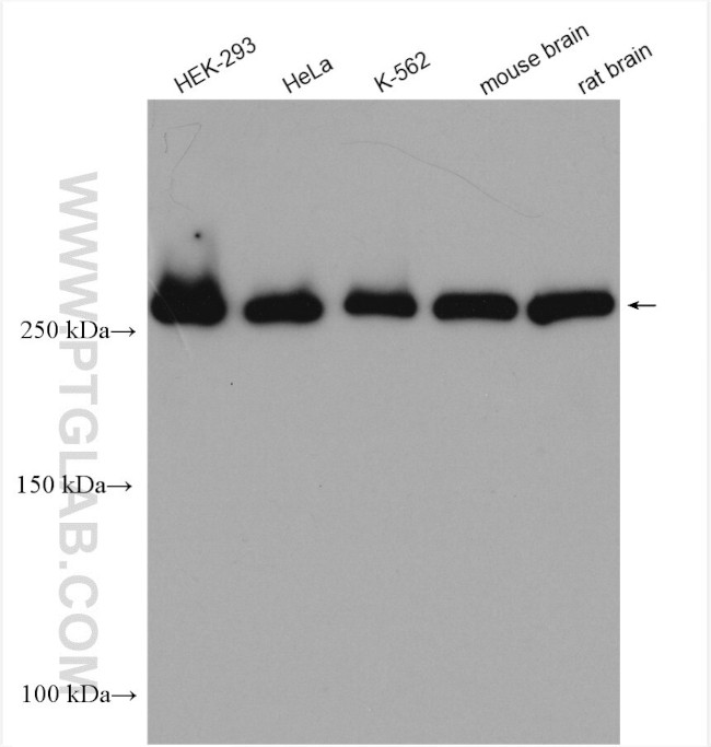 USP9X Antibody in Western Blot (WB)