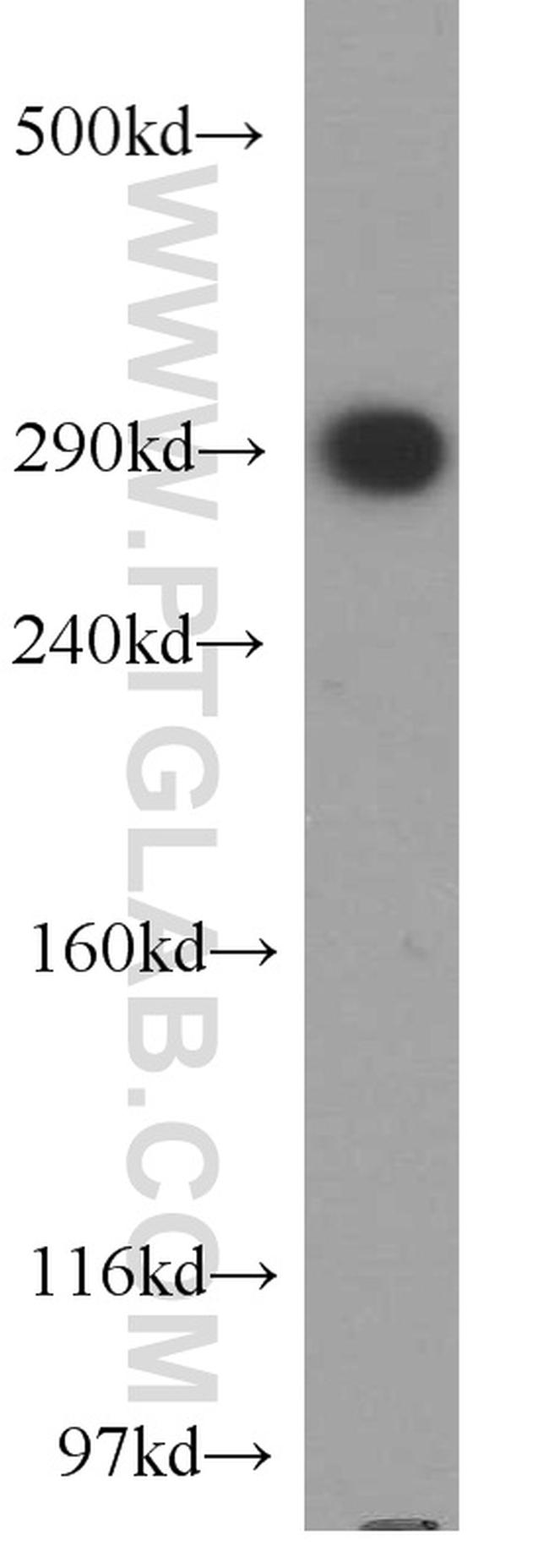 USP9X Antibody in Western Blot (WB)