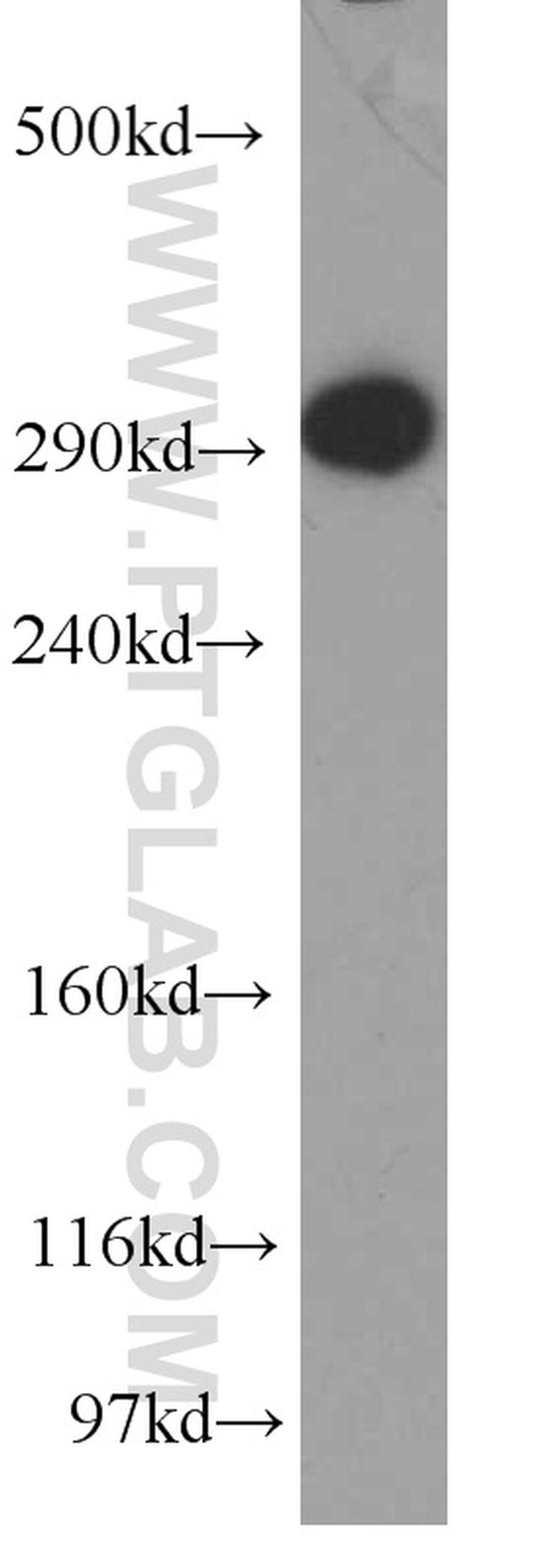 USP9X Antibody in Western Blot (WB)