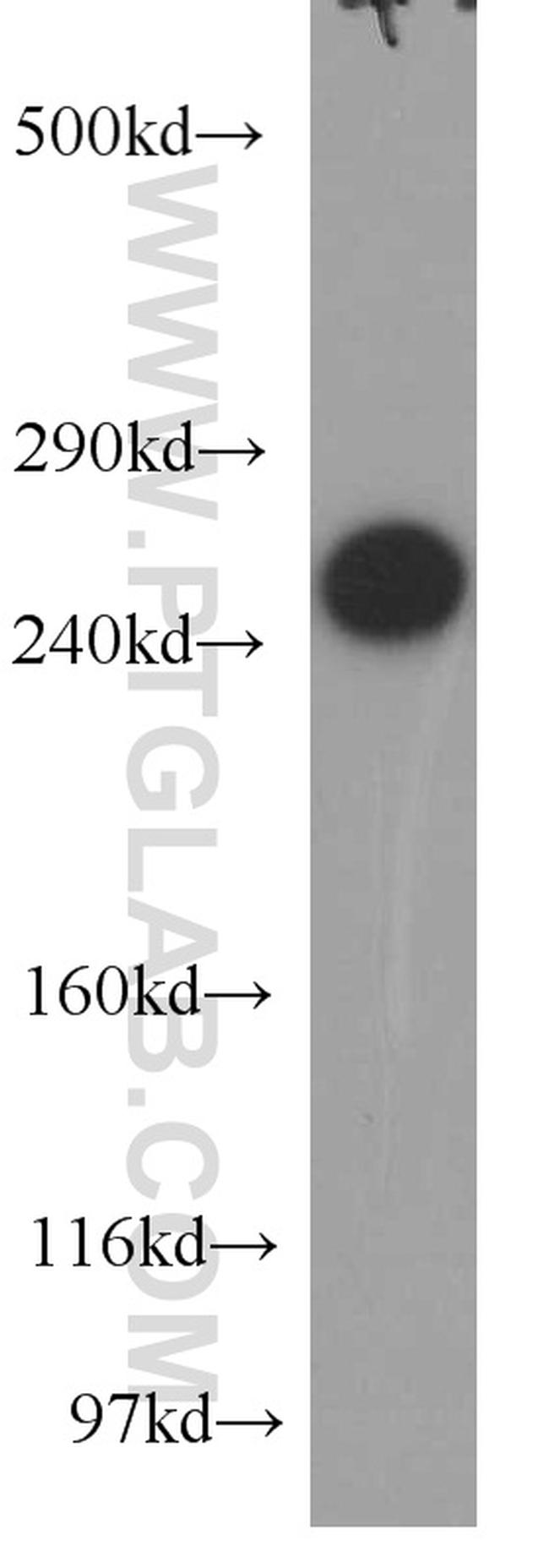 USP9X Antibody in Western Blot (WB)