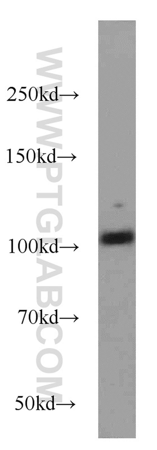 DLGAP3 Antibody in Western Blot (WB)